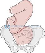 presentazione di faccia del feto 