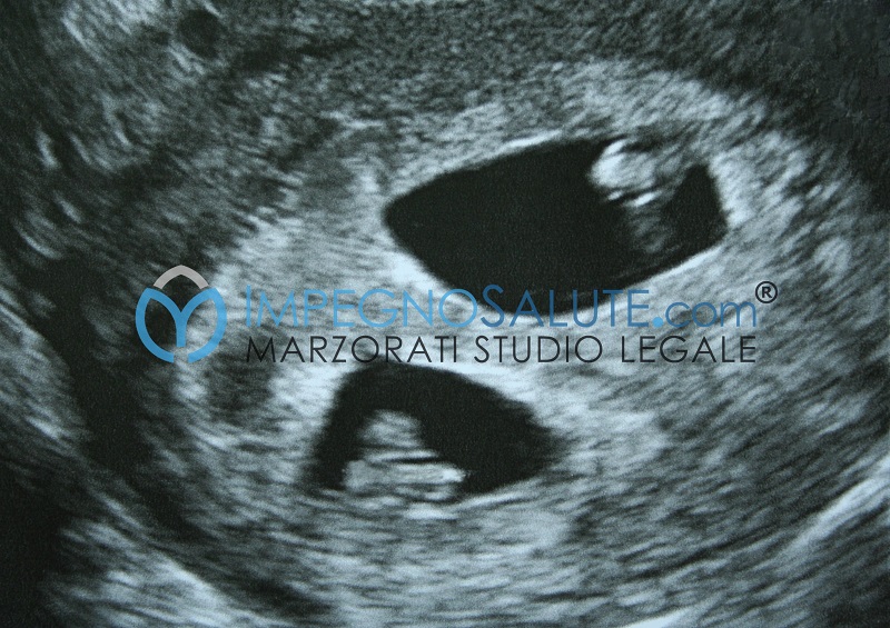 monitoraggio della gravidanza gemellare
