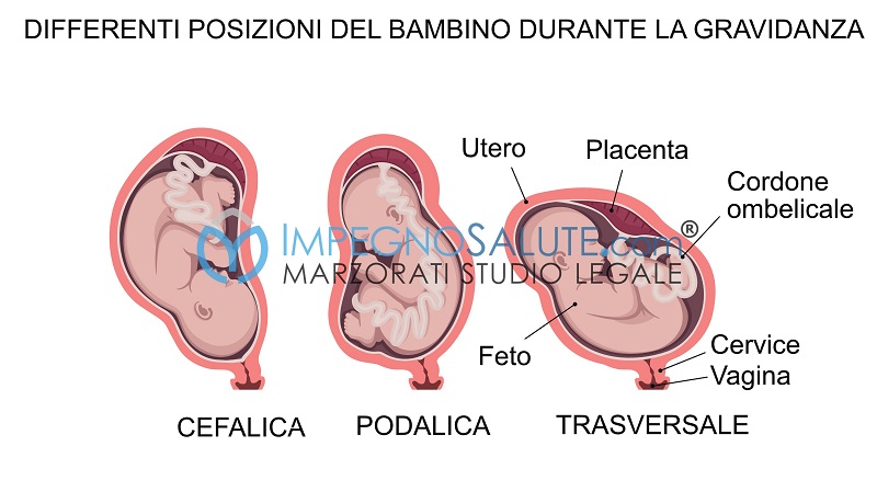 posizione feto