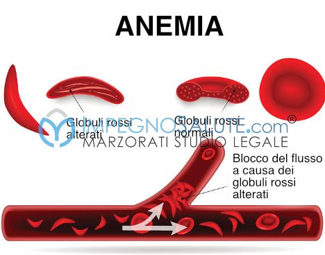 Anemia_malformazioni e malattie nel feto