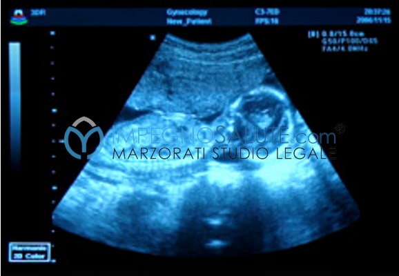 Diagnosi prenatale malformazione malattie feto