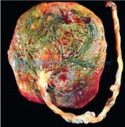Analisi placenta