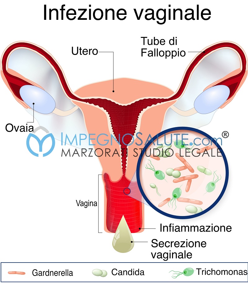 Secrezioni vaginali