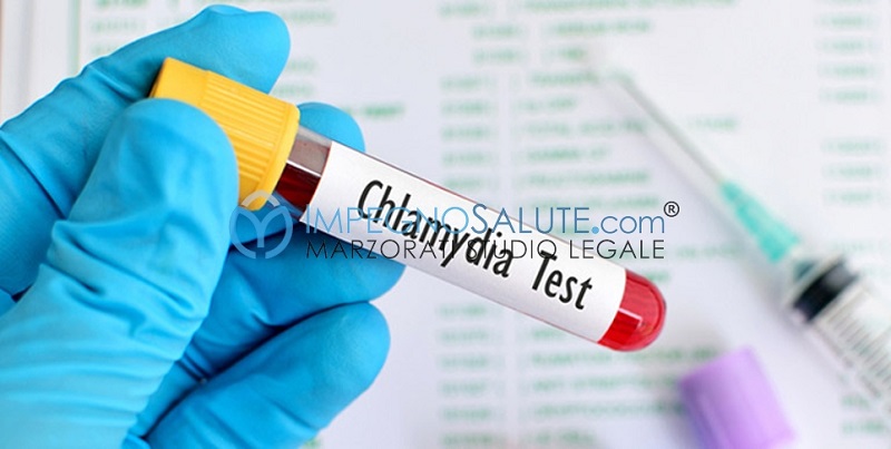 Test_Chlamydia
