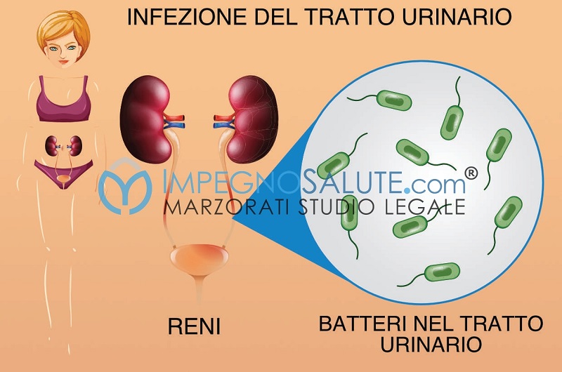 infezione-tratto-urinario