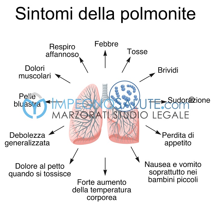 Sintomi polmonite