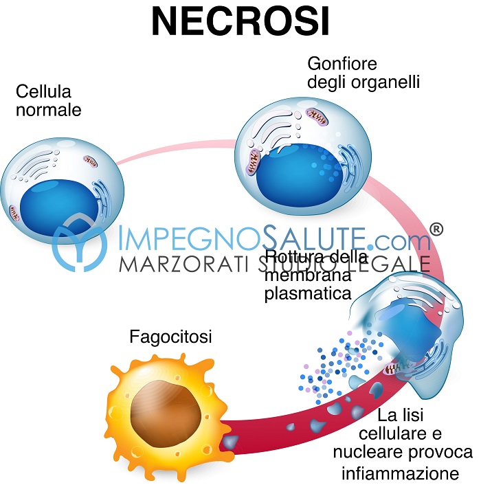 Necrosi-cellulare